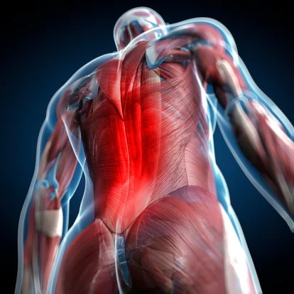 Back pain