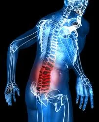 Back pain