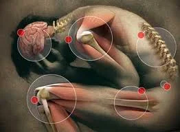 Pain Joint pain management